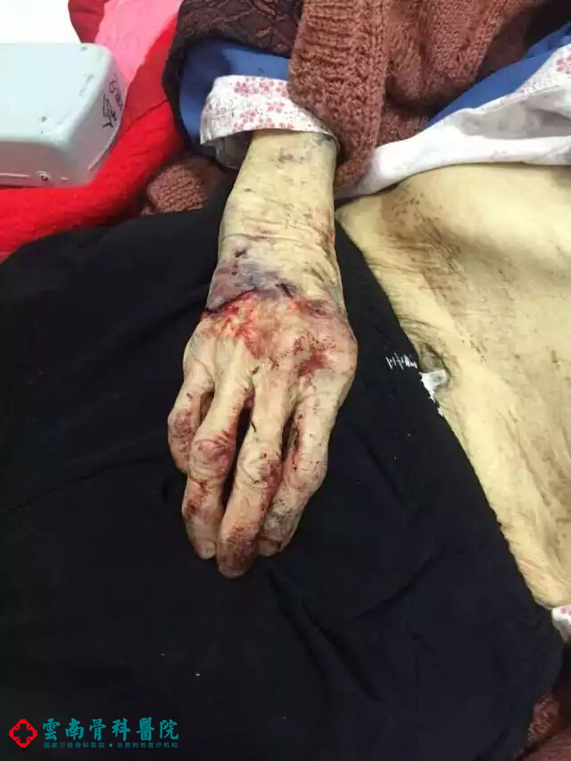 医院伤者