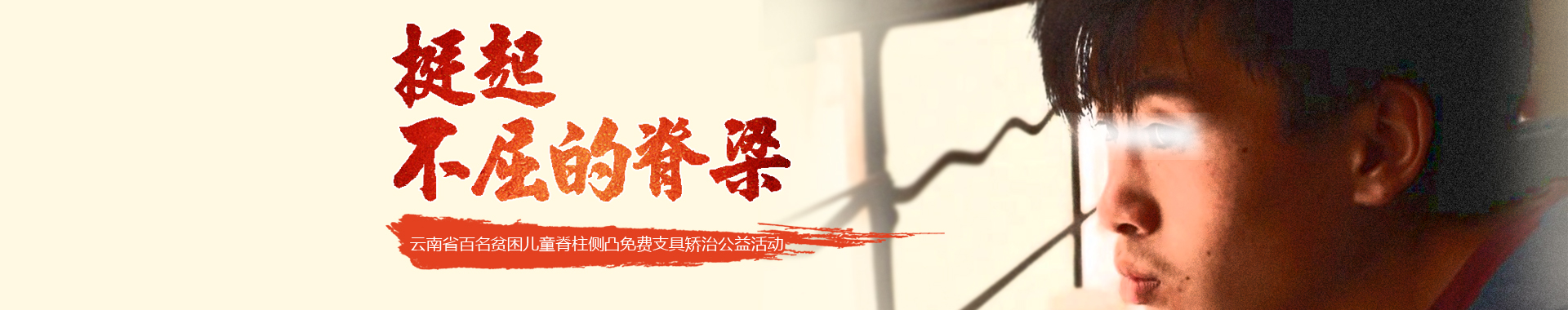 脊柱侧凸专题